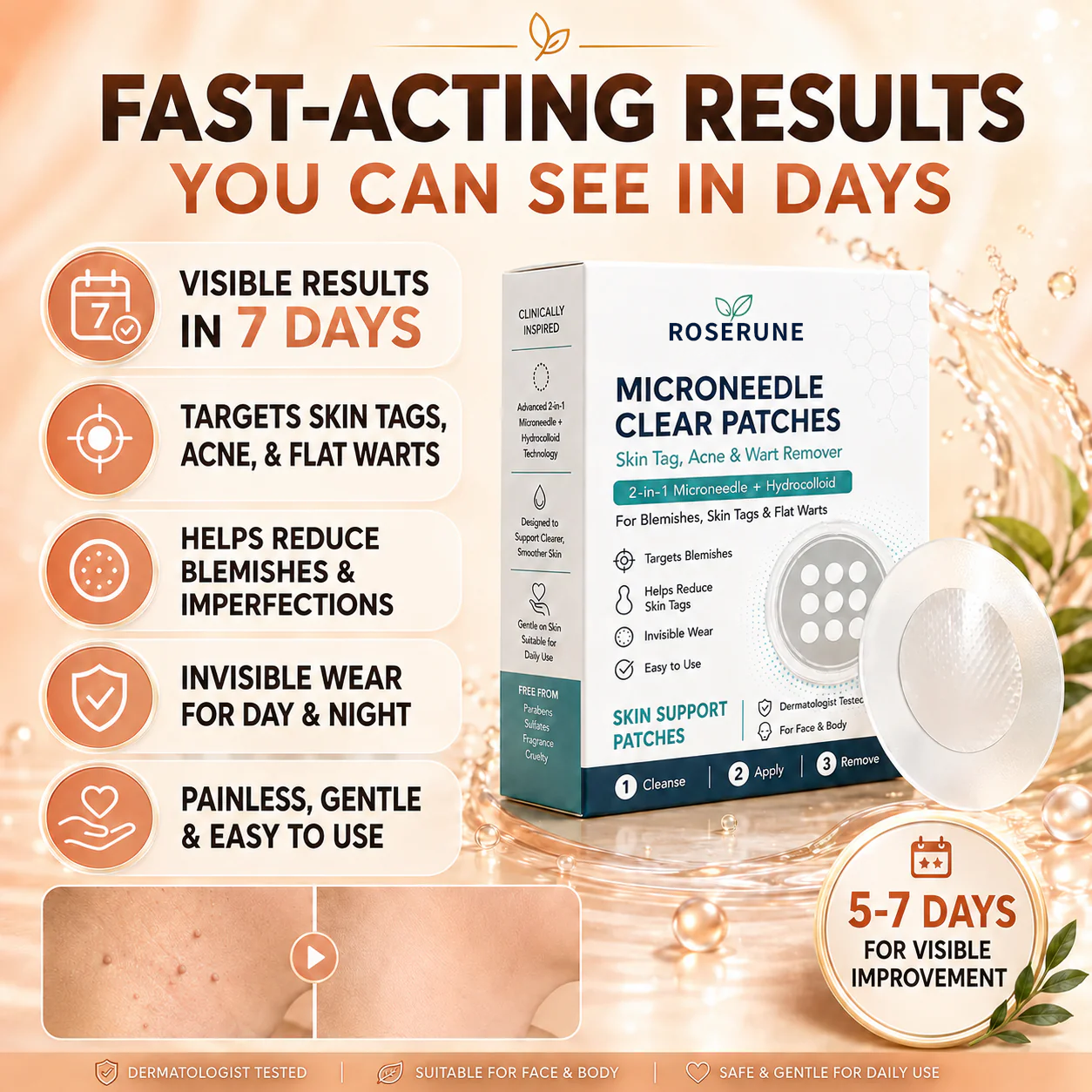 ROSERUNE® 2-in-1 Microneedle & Hydrocolloid Patch