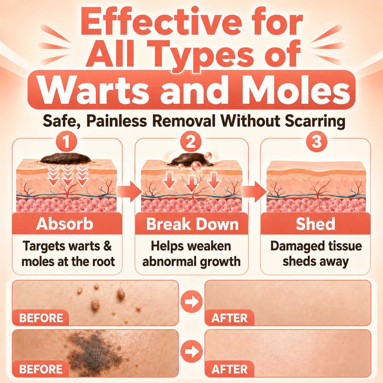 ROSERUNE® 2-in-1 Microneedle & Hydrocolloid Patch