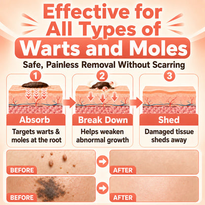 ROSERUNE® 2-in-1 Microneedle & Hydrocolloid Patch